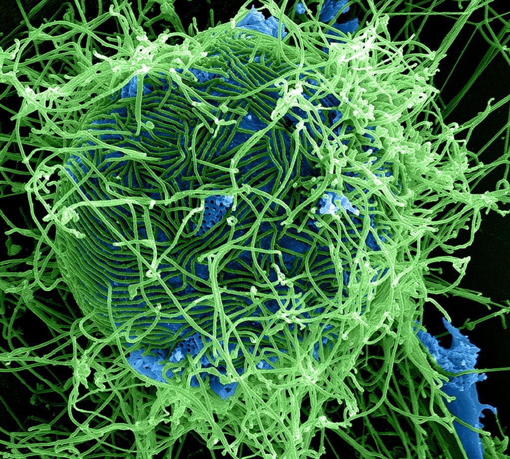 Ebola Virus Particles NIAID sample