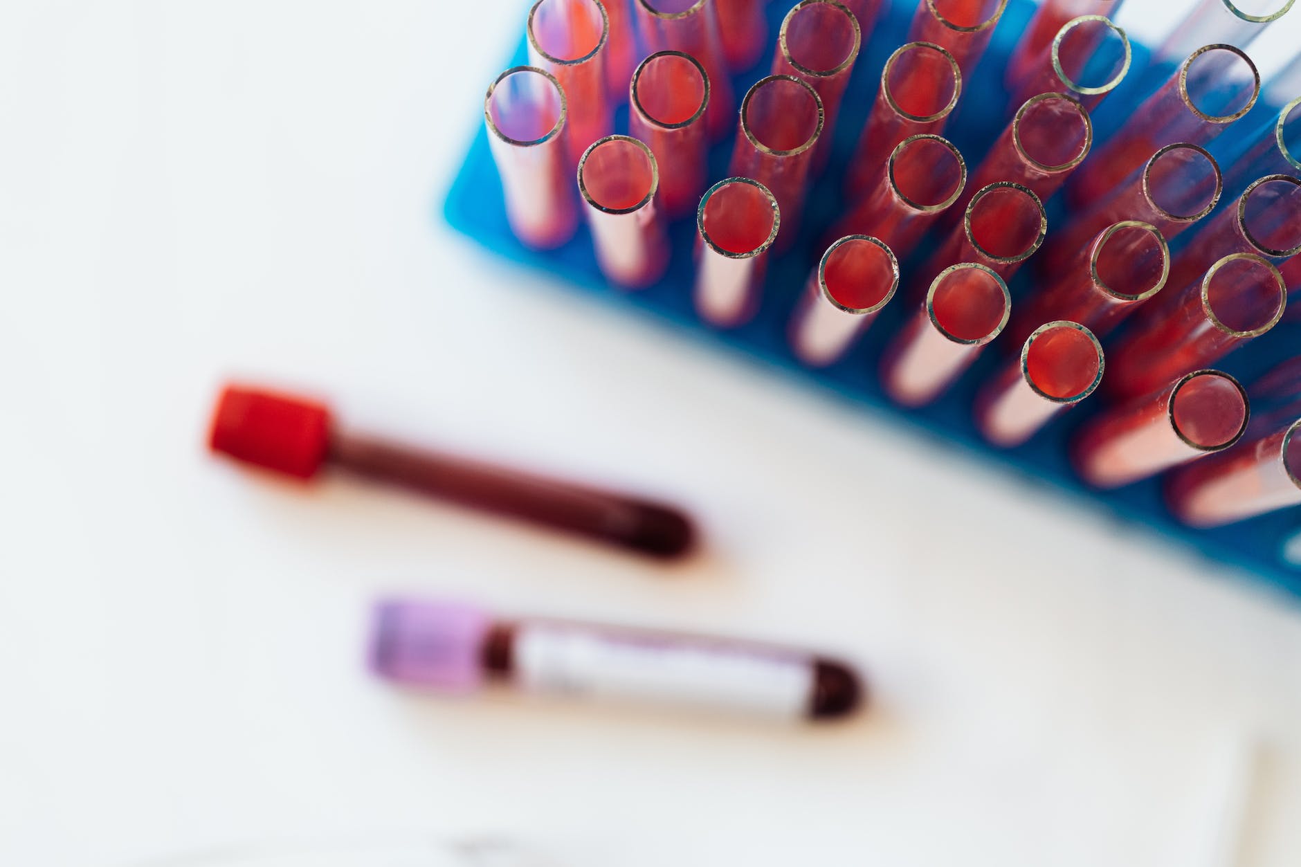 Blood glass tubes with colorful liquids on table